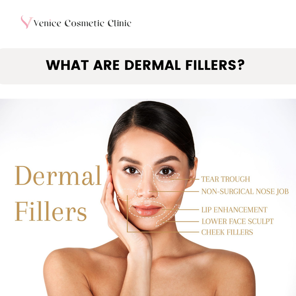 What Are Dermal Fillers?