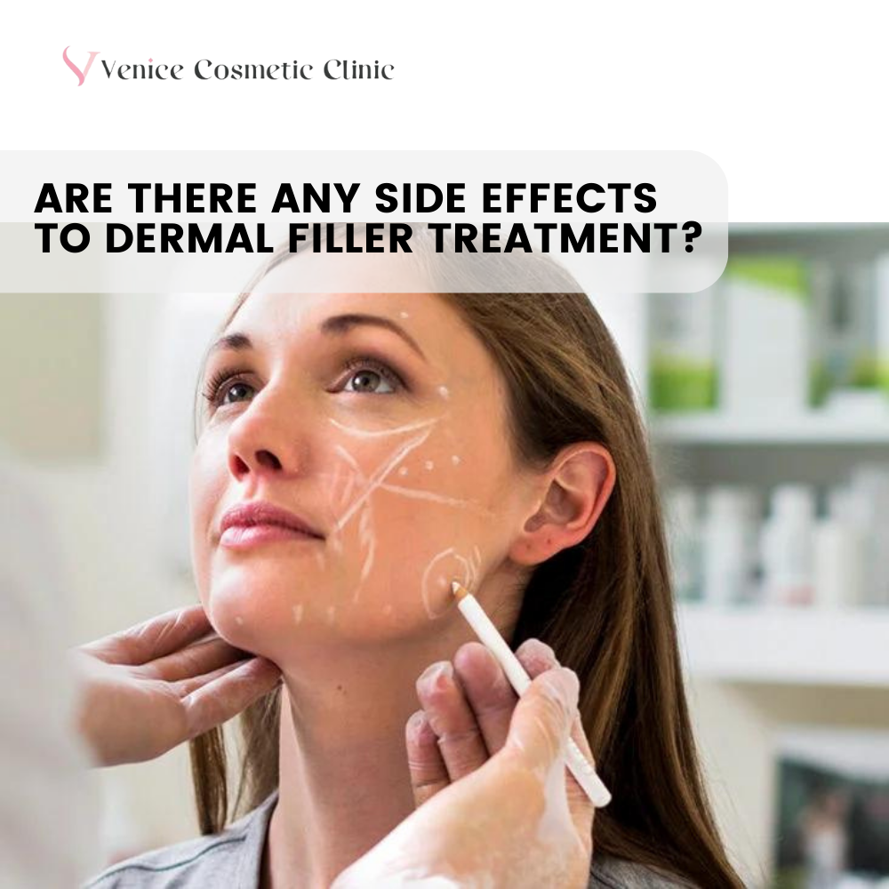 Side Effects of Dermal Filler Treatment