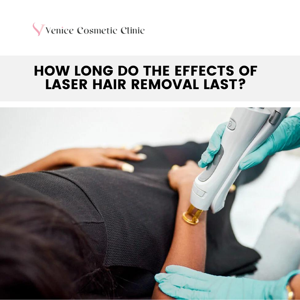 How Long Do The Effects Of Laser Hair Removal Last?