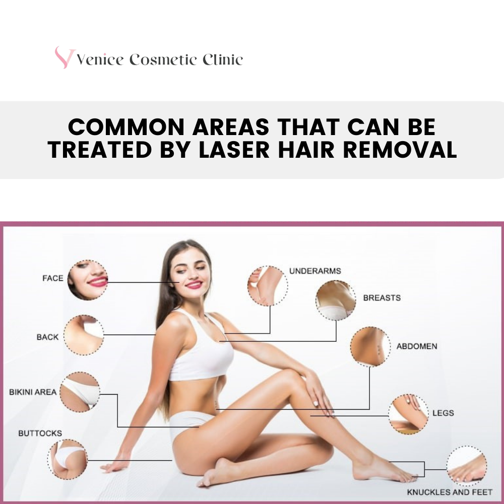 Common Areas that Laser Hair Removal Can Treat