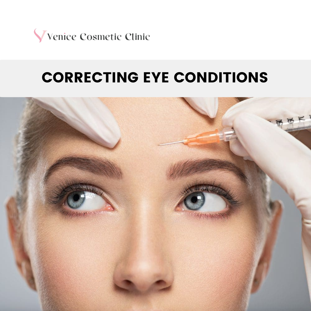 Correcting Eye Conditions