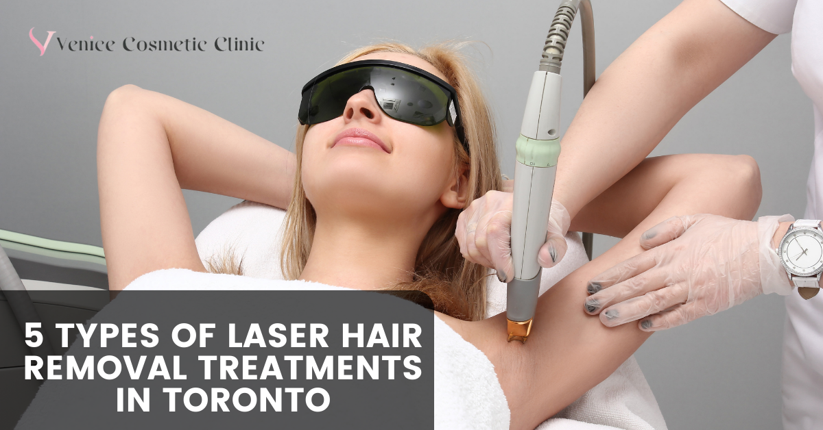 5 Types of Laser Hair Removal Treatments in Toronto