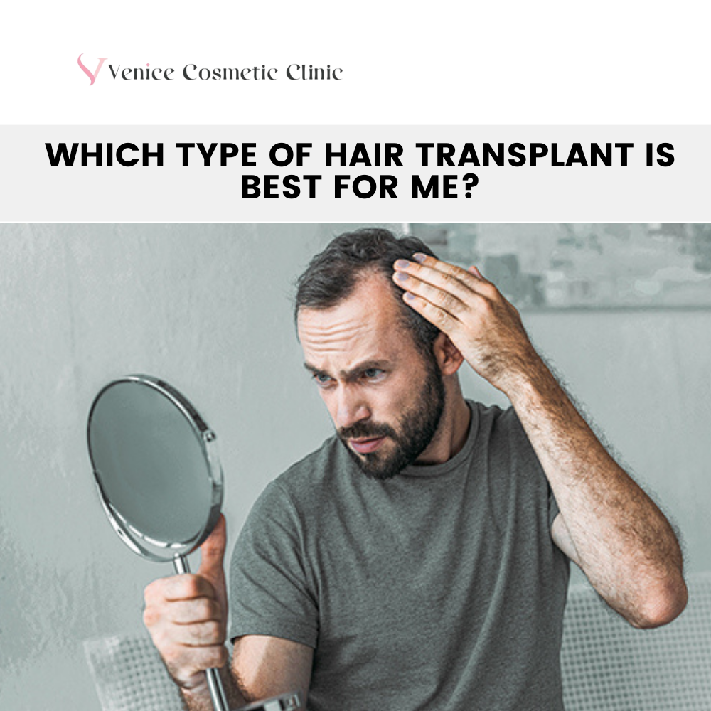 Type Of Hair Transplant Is Best For Me