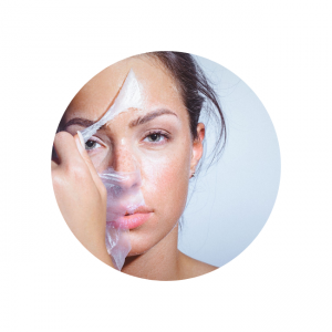 Chemical Peel