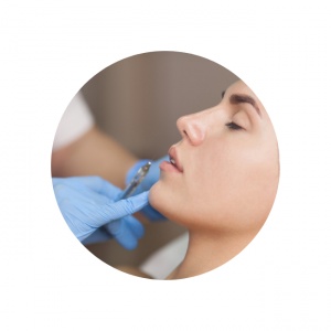 Dermal Filler